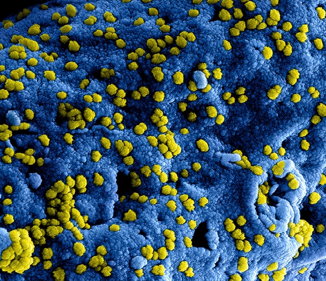 Molekulare Vorhersage von Antibiotikaresistenzen für eine maßgeschneiderte Therapie der Tuberkulose
